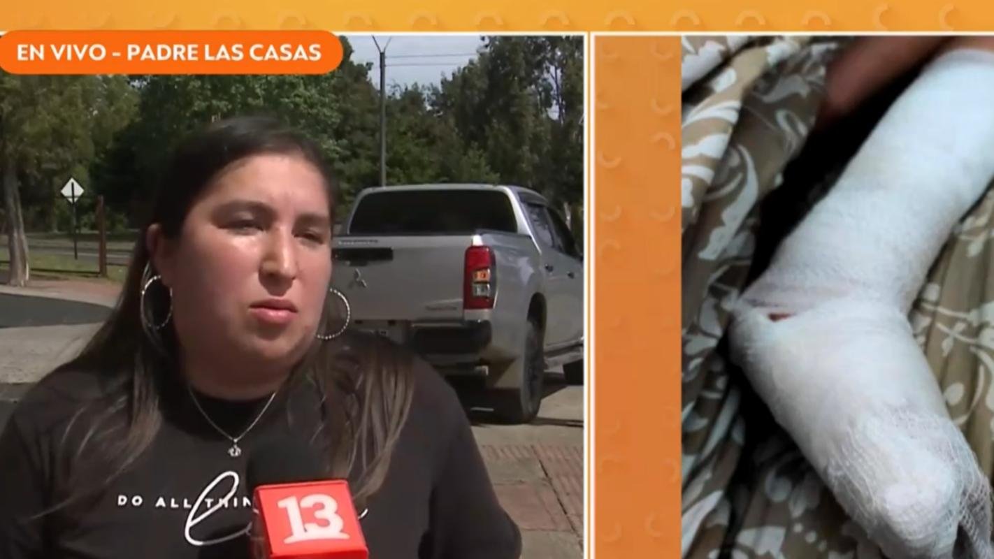 Vergüenza Nacional: niño es atendido con un cono de cartón en SAR y autoridades aseguran que “no faltan recursos”