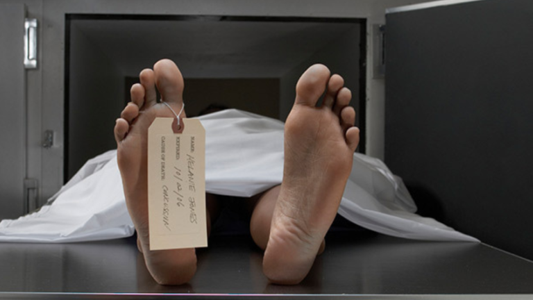 Un mercado macabro en la puerta de Chile: piernas, rodillas y tibias humanas retenidas en el aeropuerto